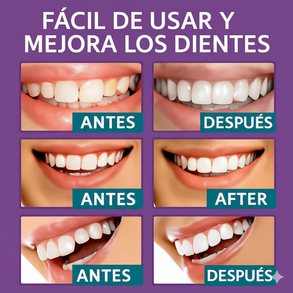 OFERTA DE HOY!⌛CARILLAS DENTALES ADAPTABLES 2X1 +ENVIO GRATIS🏡🚚